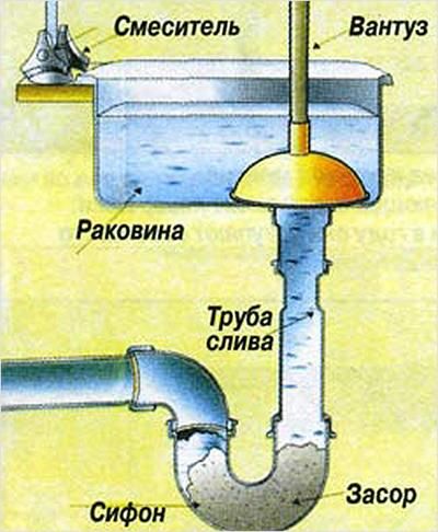 Работа с вантузом